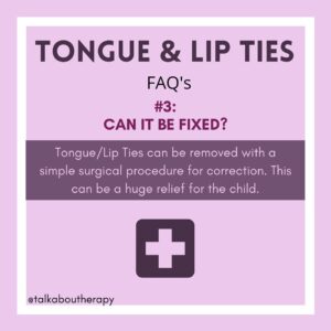 baby tongue evaluation Hapeville